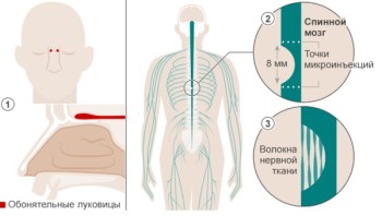 spinal_cord